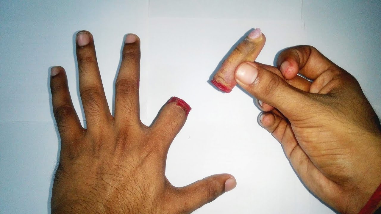 отрезанный палец