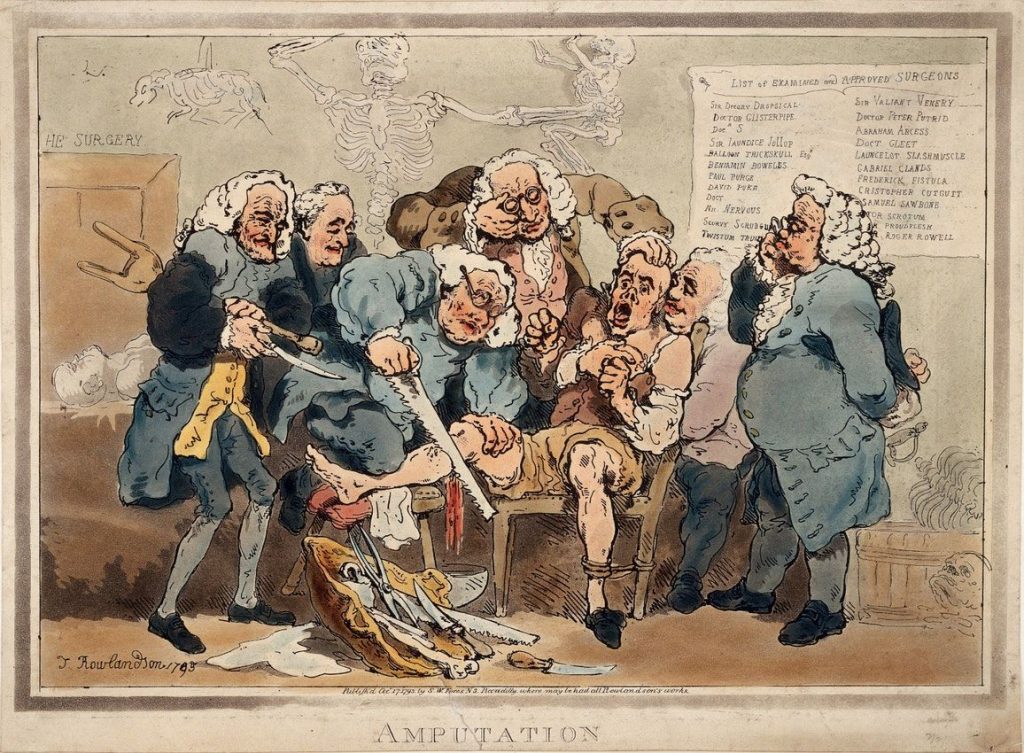 реанимация в XVIII веке безумная медицина 