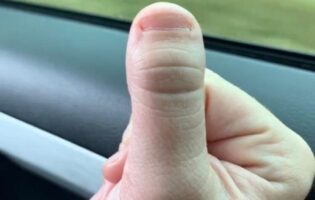 Фетиш недели: пальцы с мелкими ногтями