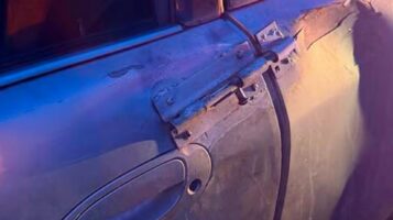 Понедельник начинается с дичи! Индиец отхватил себе ногу, чтобы поступить в медицинский