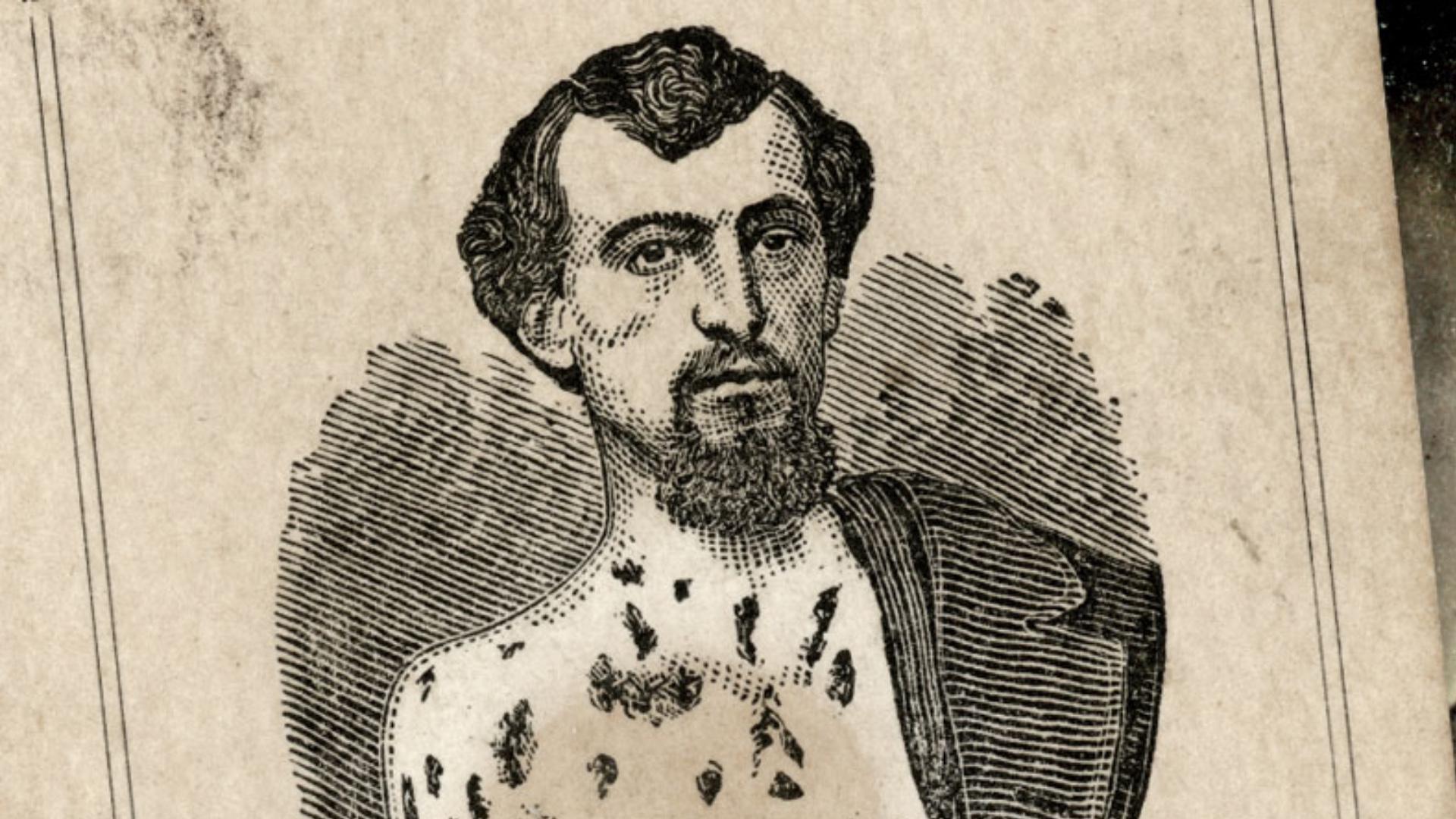 Портрет солдата с десятками пулевых и сабельных ранений на груди — один из самых ярких визуальных примеров того, через что проходили бойцы Гражданской войны. Именно такой «хирургический музей» на теле увидел врач у Жака Рёллингера в 1865 году, когда тот пришёл за пенсией.